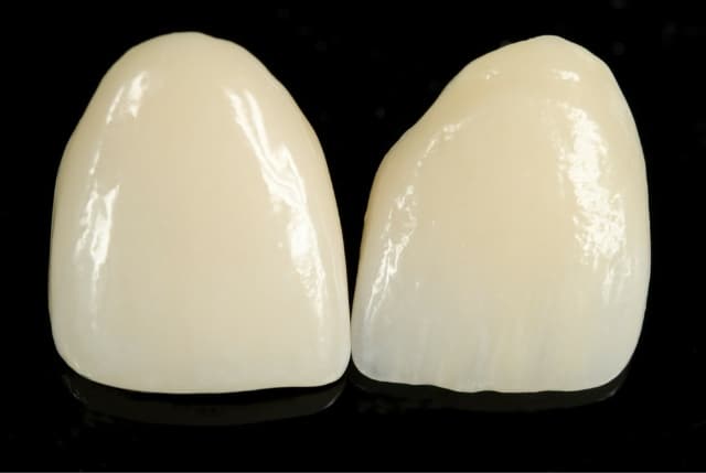 dental crowns bellville