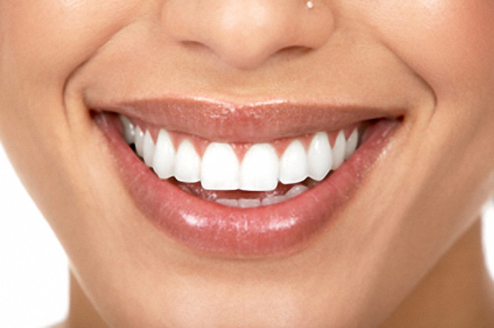 partial dentures bellville