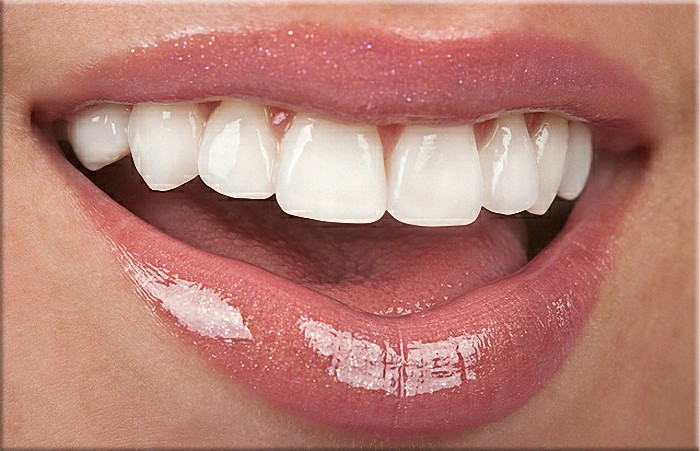 partial dentures brackenfell